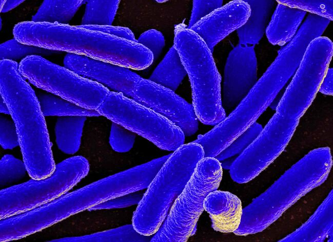 E. coli provoca molto spesso lo sviluppo di cistite nelle donne